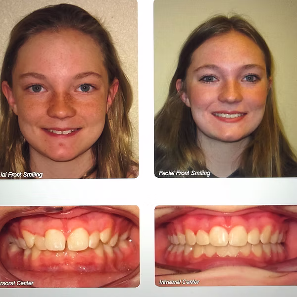 before and after photos